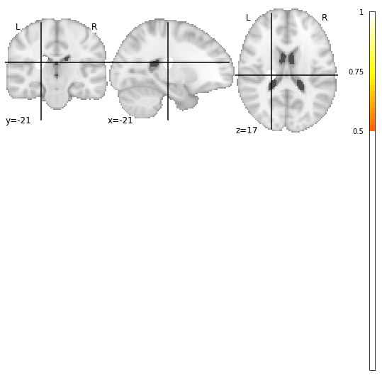 3d Brain Tumor segmentation in Python