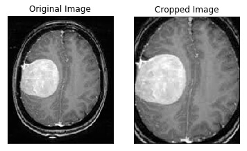 Brain Tumor Detection