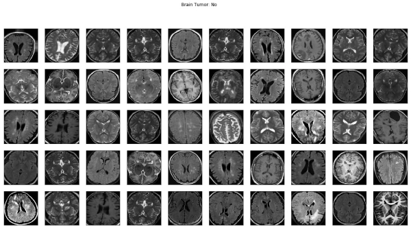 Brain Tumor